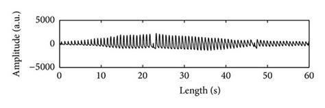 This figure shows examples as (a) oscillometric waveform (OMW); (b) OMW... | Download Scientific ...