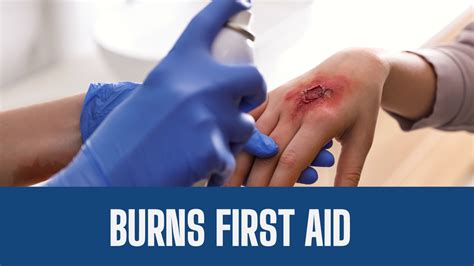 First Aid for Burns: Immediate Actions and Treatment