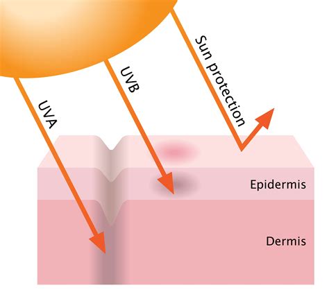 How Sunburns Can Damage Your Skin - Fullerton, CA