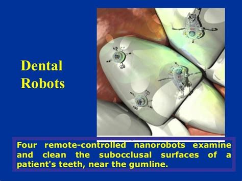 nanorobots and its applications in medicine