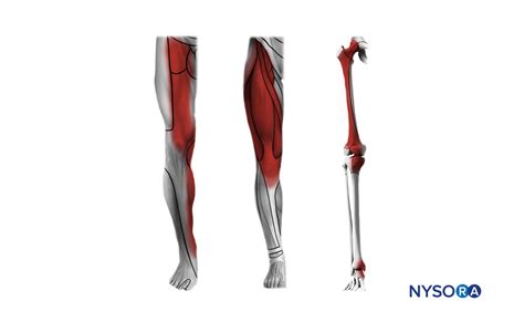 CME COURSE - LOWER EXTREMITY BLOCKS PART I - NYSORA e-Learning System