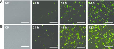 gFP expression in transfected hepg2 cells. Notes: cK: untransfected... | Download Scientific Diagram