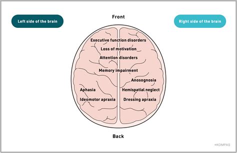 Traumatic Brain Injury | SanBio - Official Site