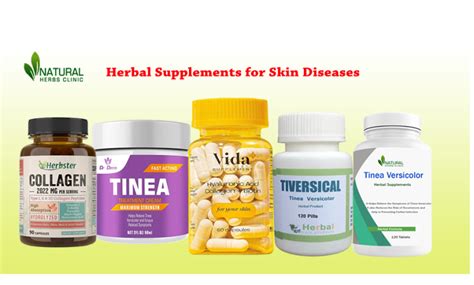 Common Skin Disease and Treatment Using Herbal Supplements