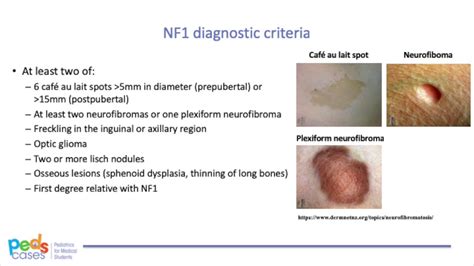 Neurocutaneous Disorders - YouTube