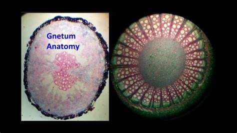 Gnetum Anatomy - YouTube