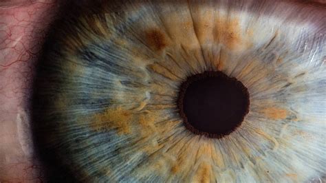 What is Achromatopsia? — Foundation Fighting Blindness