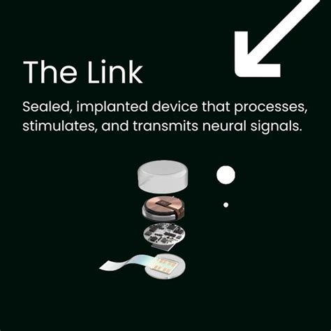 “That Is The Goal”: Elon Musk’s Neuralink Is Implanted In First-Ever ...