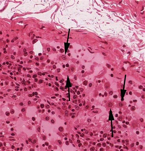 Connective Tissue | histology