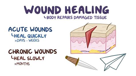 Wound healing: Video, Anatomy, Definition & Function | Osmosis