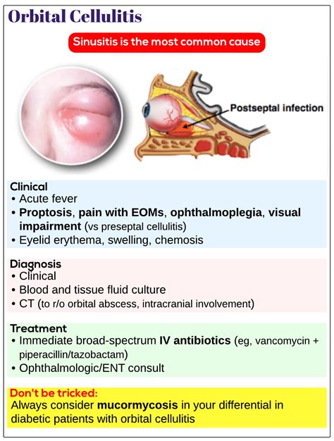 Orbital Cellulitis Adult Treatment