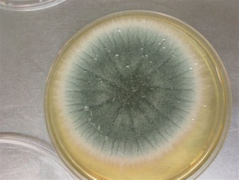 Aspergillus fumigatus - Allergy, Symptoms, & Treatment | Mold Busters