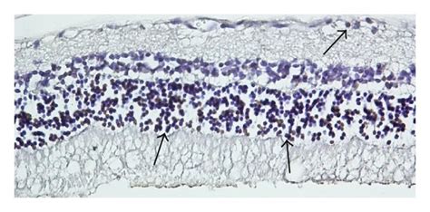 Tunel staining. Representative photographs of tunel staining in control... | Download Scientific ...