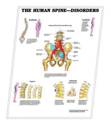 Promotif. 3D ANATOMICAL CHART THE HUMAN SPINE - DISORDERS