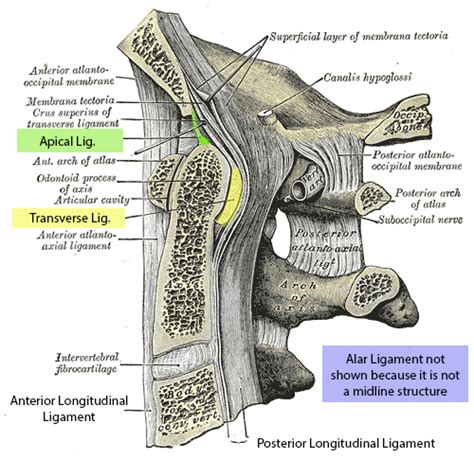 Atlantoaxial Instability - Spine - Orthobullets