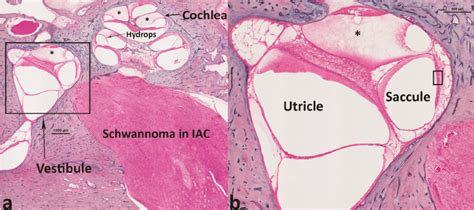 Utricle Histology