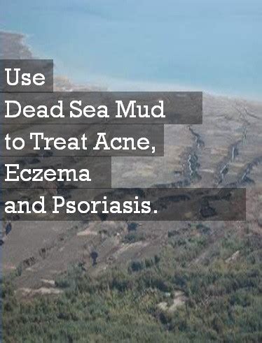 5 Popular Dead Sea Mud Mask Benefits - Skin Disease Remedies