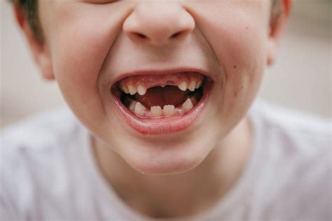 When Do Baby Teeth Fall Out? A Guide for Parents