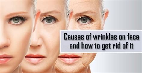 Causes of Wrinkles on Face and How to Get Rid of It