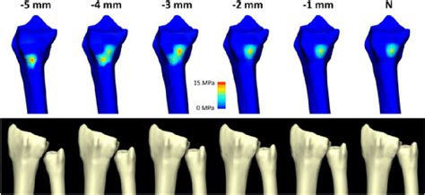 Location of contact on radial sigmoid notch for up to 5 mm of ulnar... | Download Scientific Diagram