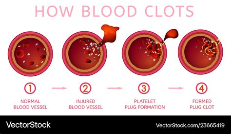 Blood clotting process Royalty Free Vector Image