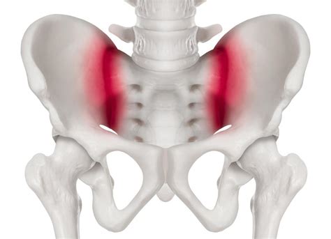 Sacroiliac Joint Injection Treatment - Plainsboro Township, NJ & Freehold, NJ: Regenerative ...