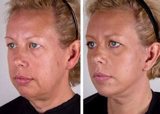 8 Great Facial Exercises That Help Lift Your Jowls | New Health Advisor