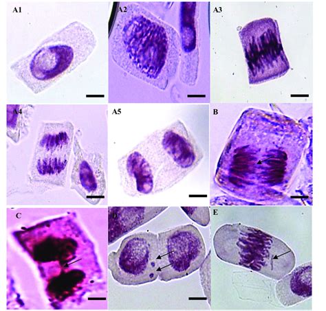 Plant Stages Of Mitosis Under Microscope Micropedia | sexiezpix Web Porn