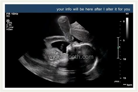 Funny Baby Ultrasound