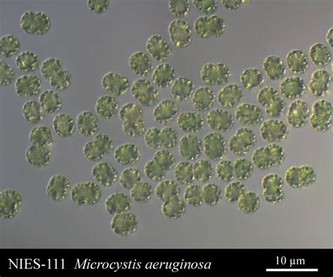 Microcystis aeruginosa Microbiology, Aac, Lichen, Ecology, Fresh Water, Moss, Toxic, Species, Common