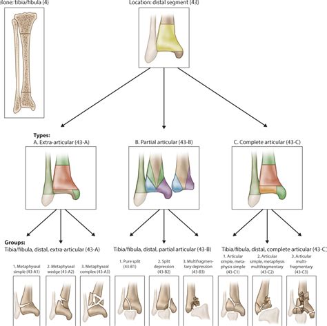 Distal Fibula Fracture Classification