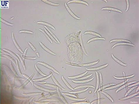 Fusarium wilt