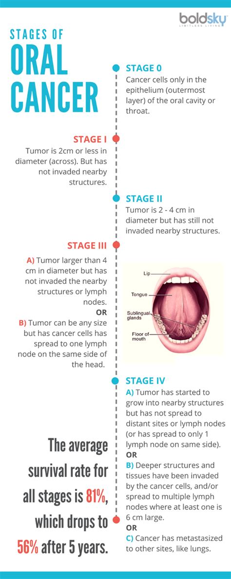 What is Oral Cancer? Symptoms, Stages, and Cure - Boldsky.com