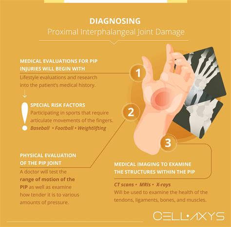 What To Do About Proximal Interphalangeal (PIP) Joint Pain? - Cellaxys