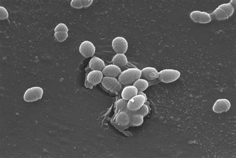 Enterococcus faecalis: Infections, transmission, and treatment