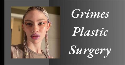 Grimes Plastic Surgery: The Truth About Her Transformative Beauty ...