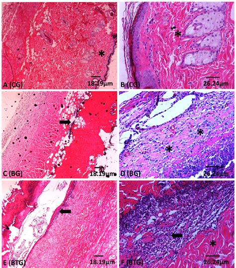 The collagen fibers (asterisk) within the skin from the study animals ...