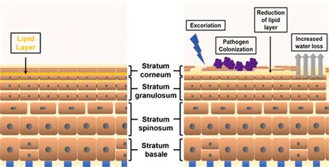 Barrier function in healthy and AD skin. Keratinocytes proliferate in ...