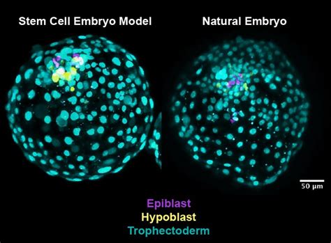 Early Human Embryo Structure Created With Stem Cells in Advance for Fertility Research