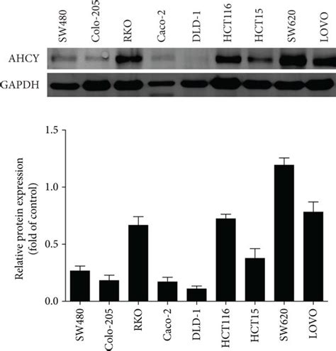 AHCY overexpression induced cell proliferation and colony formation ...