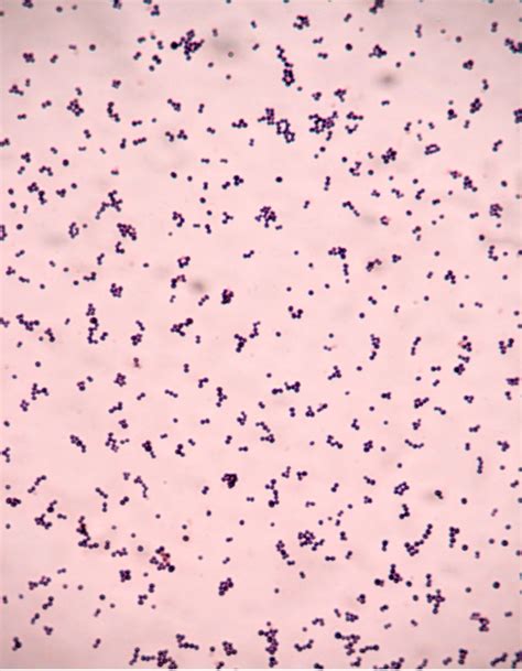 Gram Negative Cocci In Clusters