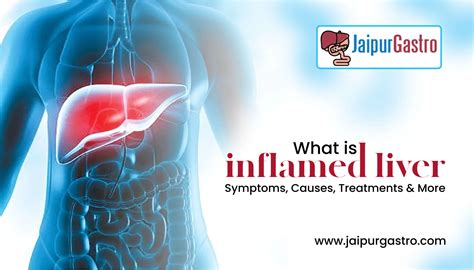 What is inflamed liver - Symptoms, Causes, Treatments & More?