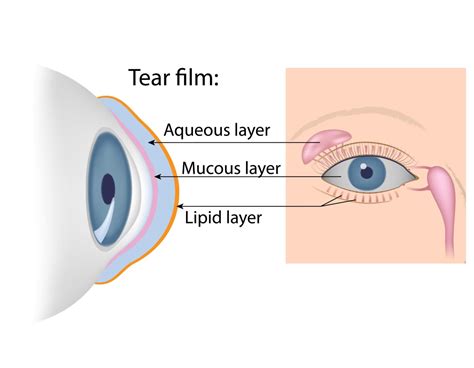 9 Causes of Glassy Eyes & Treatments