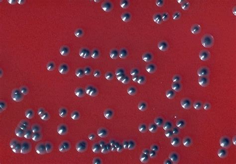 Public Domain Picture | Blood agar plate culture of Corynebacterium diphtheriae (gravis), rough ...