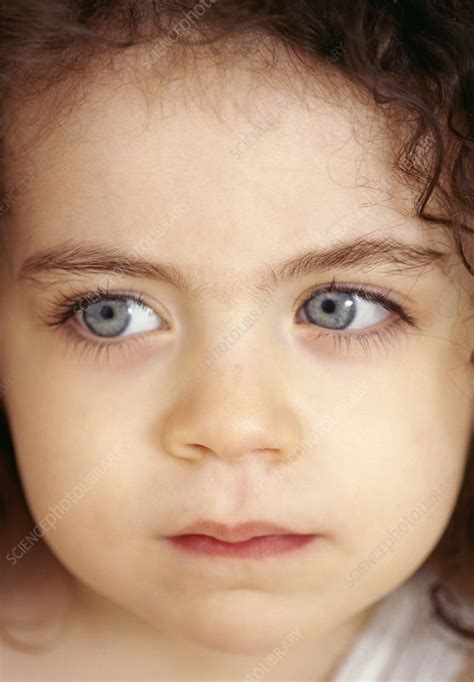 Child's face - Stock Image - M830/1349 - Science Photo Library