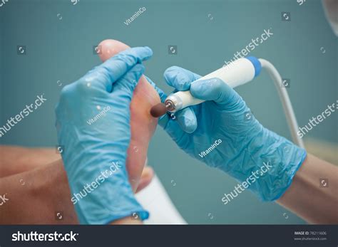 Peeling Feet Pedicure Procedure Beauty Salon Stock Photo (Edit Now) 78211606