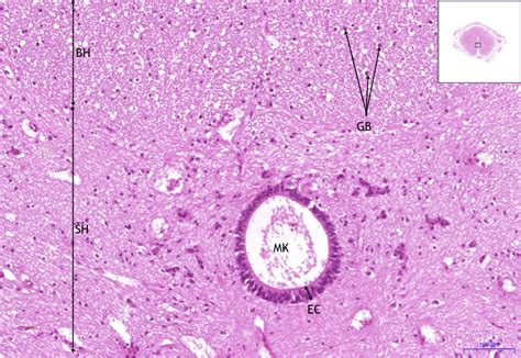 Mícha / Spinal cord - HE – WikiSkripta