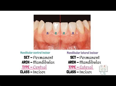 Mandibular Central Incisor