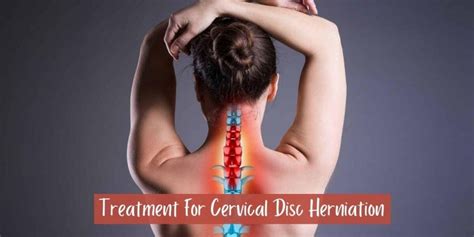 Treatment Of Cervical Pain | Neck pain, It's Symptoms And How To Deal ...