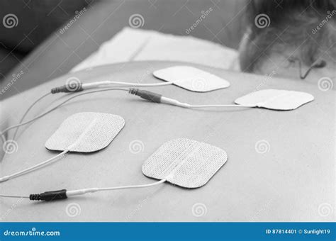 TENS Electrodes Positioned for Back Pain Treatment in Physical T Stock Image - Image of chronic ...